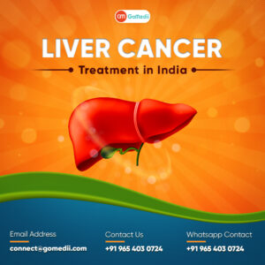 Which is the best liver cancer treatment in India 