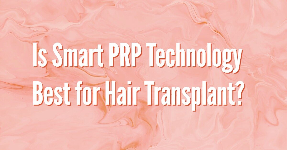 Is Smart PRP Technology Best for Hair Transplant?