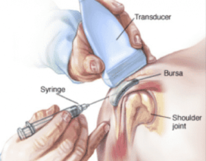 How to ultrasound injection works