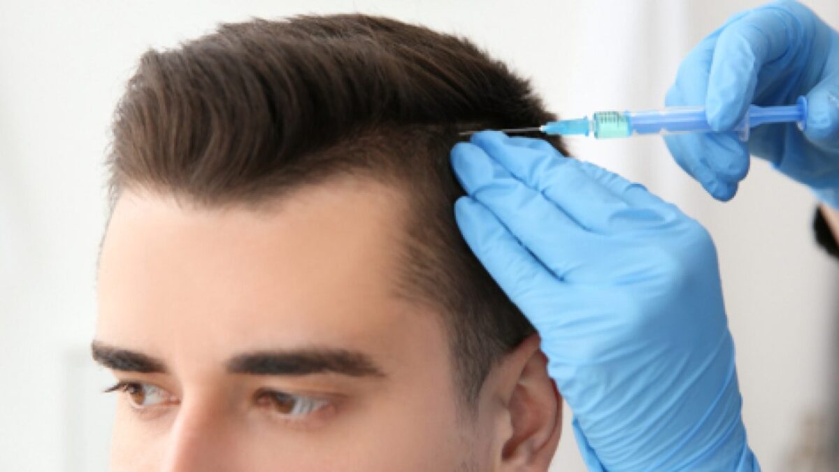 How To Overcome Pattern Baldness Issue By Hair Restoration?
