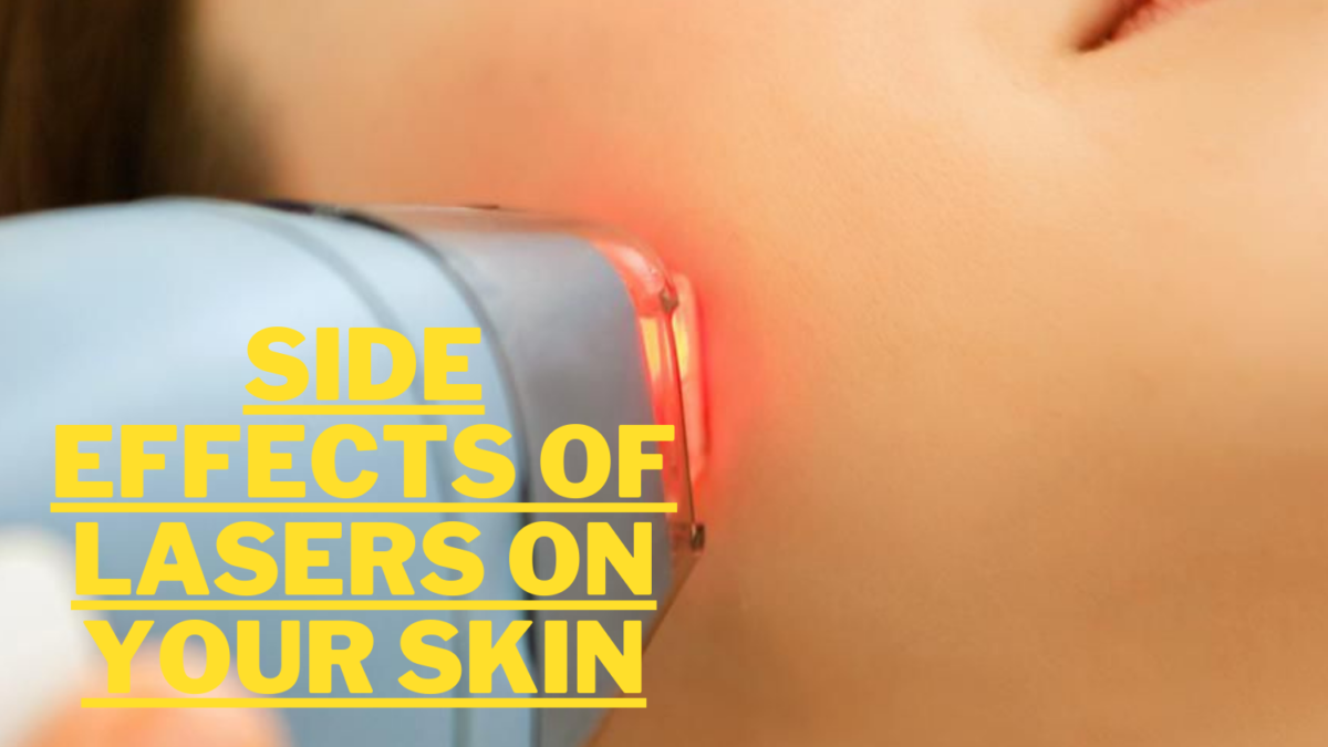 Side Effects of Lasers on Your Skin