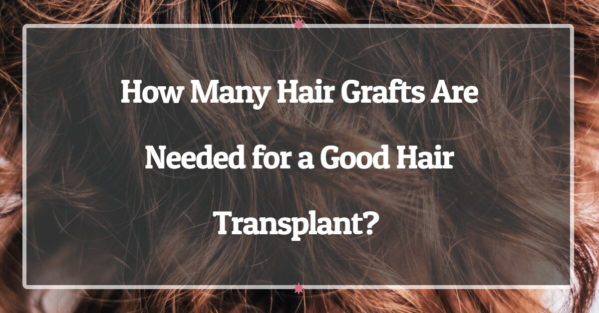 How Many Hair Grafts Are Needed for a Good Hair Transplant?