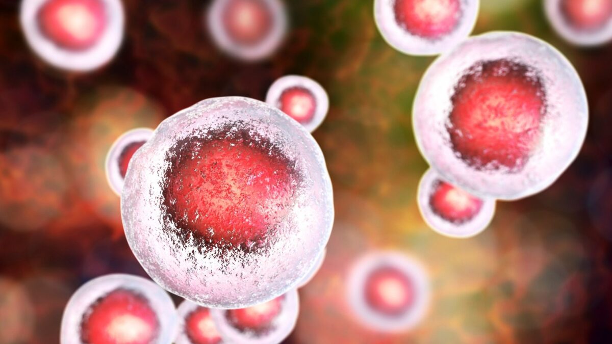 5 Things To Know About Stem Cell Treatments