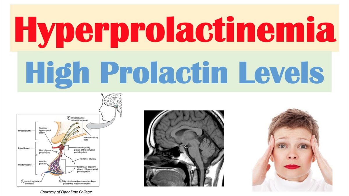 Prolactin Boost – The Key to Infertility and A Fertility Treatment