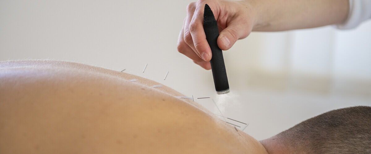 Complete Details About the Acupuncture Therapy
