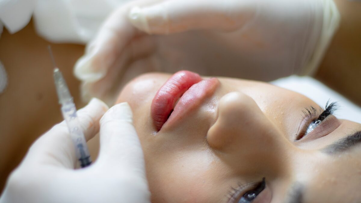 Know More about Dermal Fillers
