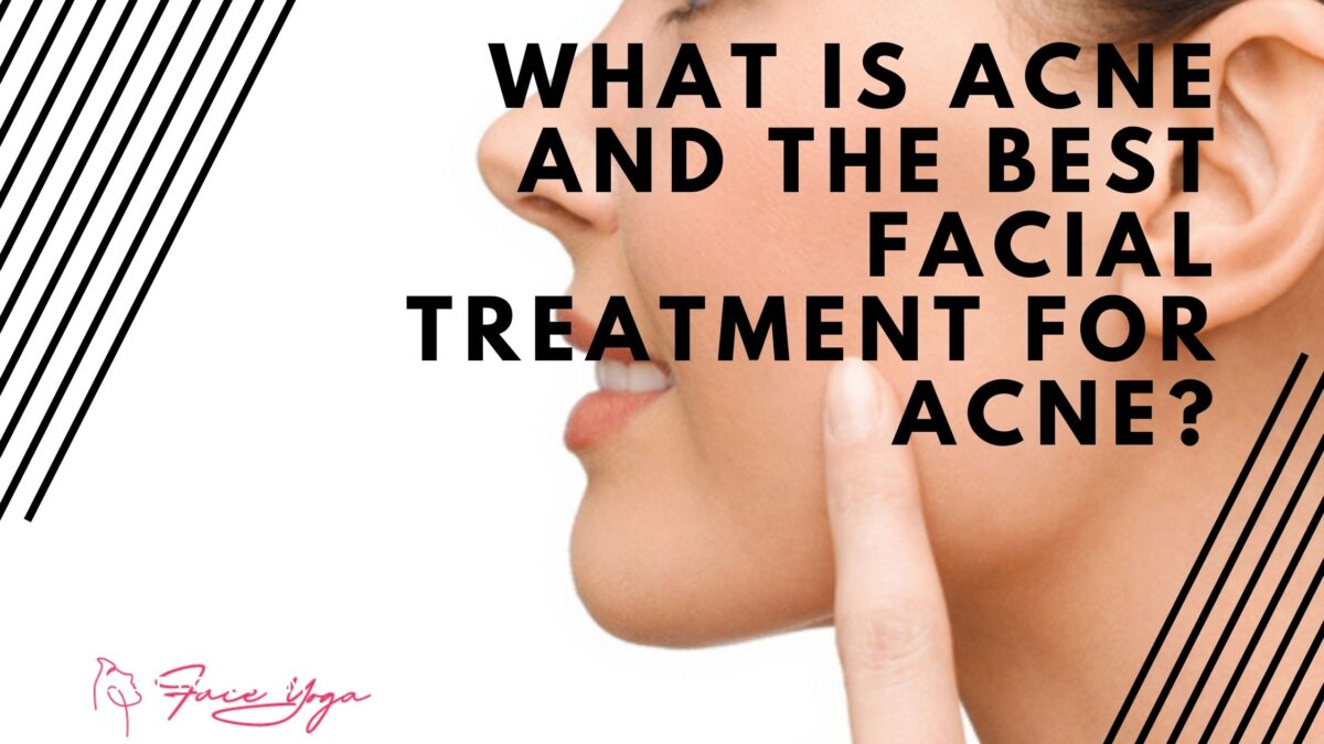 What is Acne and The Best Facial Treatment for Acne?