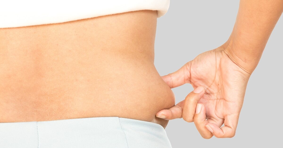 What Should I Know Before Liposuction Surgery?
