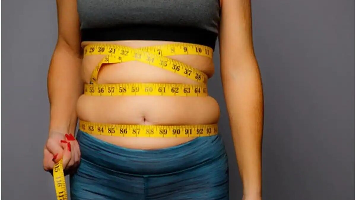 The Fundamental Role of Plastic Surgery in Healing The Outcomes of Obesity