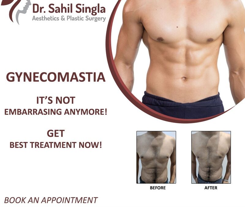 Gynecomastia Surgery: A Guide To Know About It