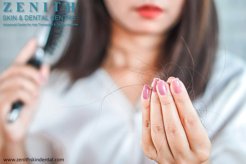 FIND OUT WHAT CAUSES HAIR LOSS AND HOW TO TREAT IT