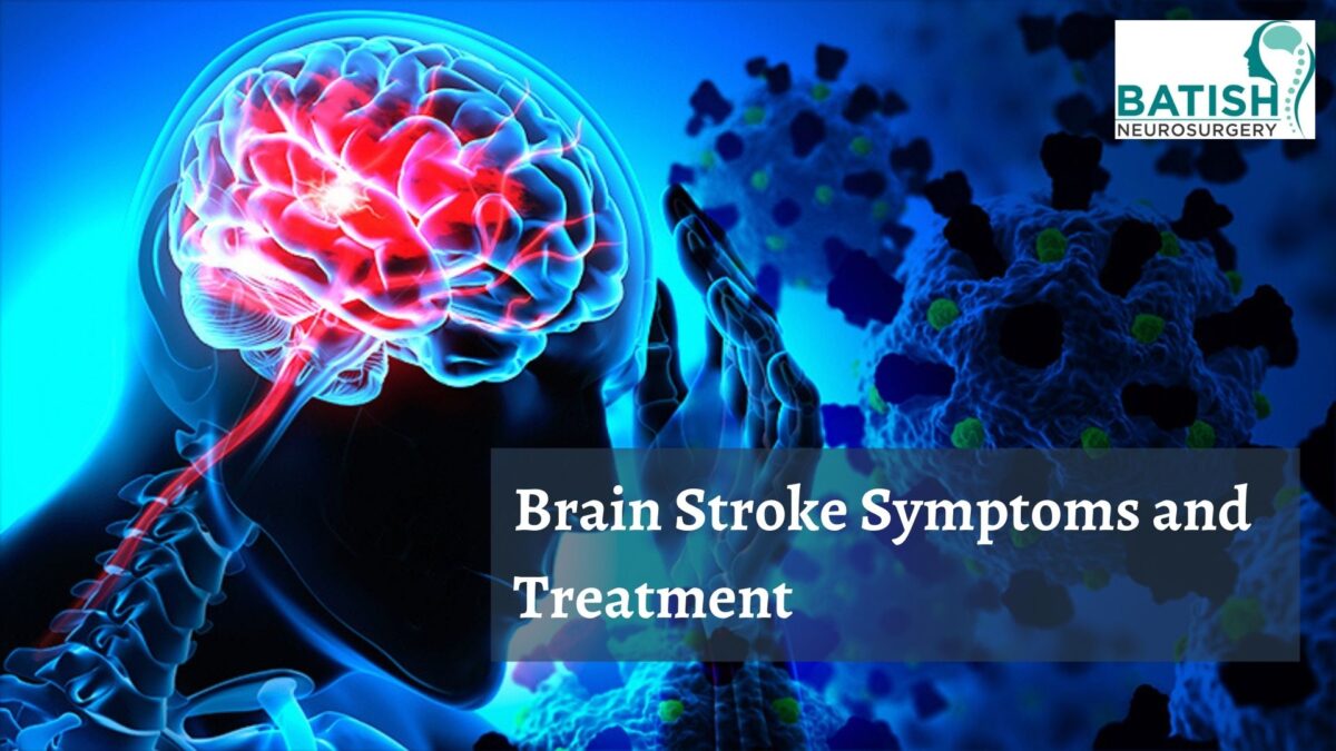 Symptoms and Treatment of Brain Stroke