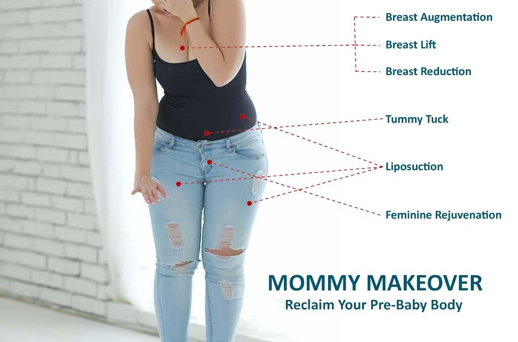 Mommy makeover: Recover your figure after pregnancy