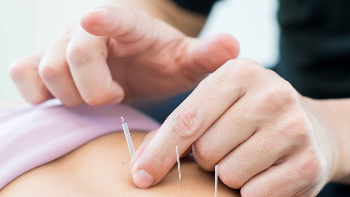 What are the Myths Surrounding Acupuncture In Indianapolis?