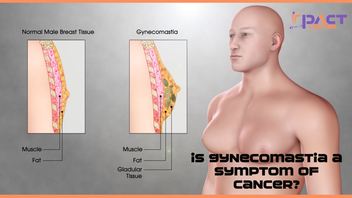 Is Gynecomastia a Symptom of Cancer?