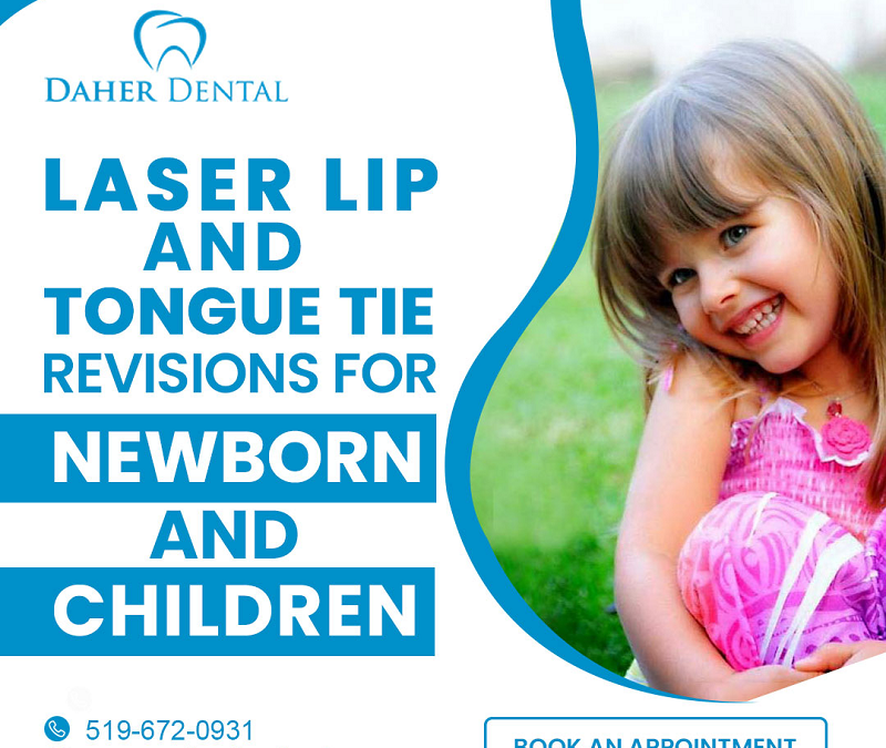 Laser Lip and Tongue Tie Revisions for Newborns