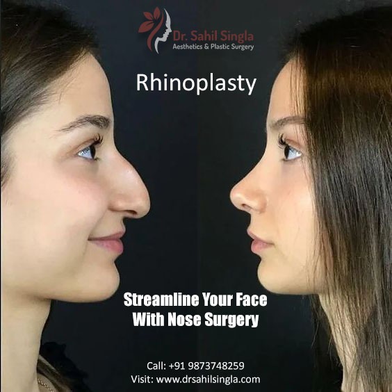 Rhinoplasty hurts and other fears to banish about the nose job