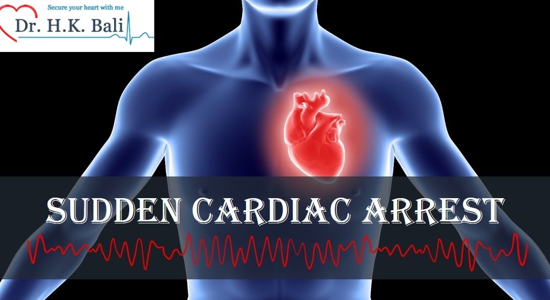 Signs and Symptoms of Sudden Cardiac Arrest