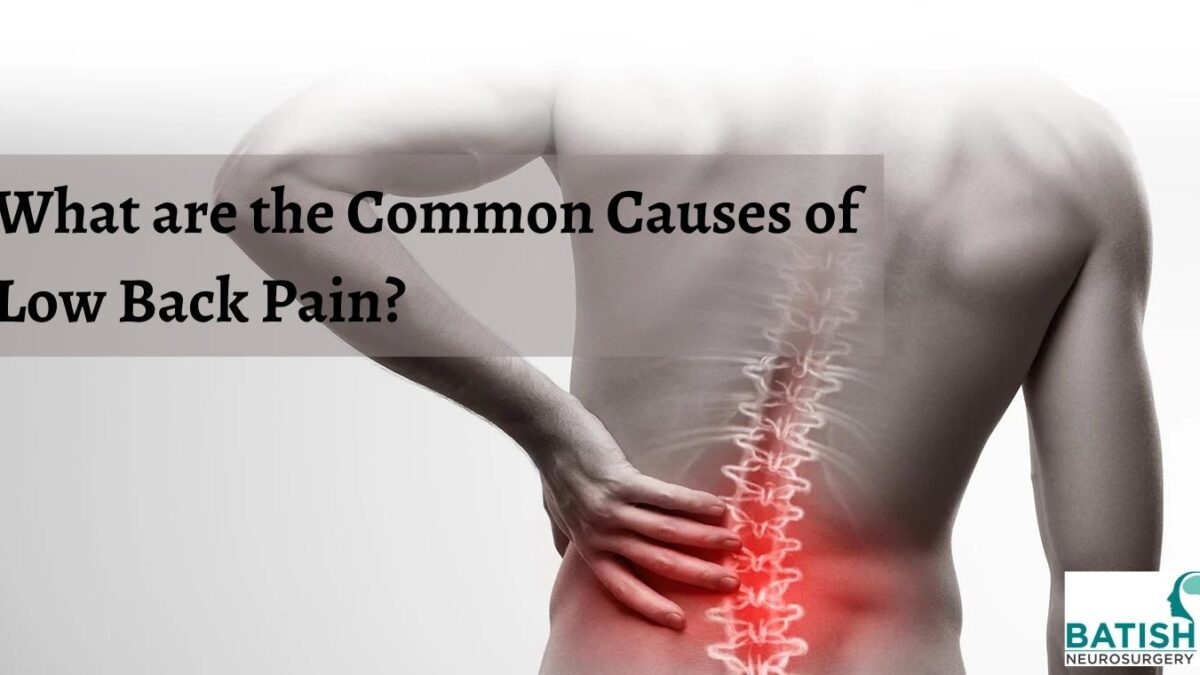 What are the Common Causes of Low Back Pain?