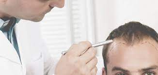 How Much Does a Hair Transplant Cost?