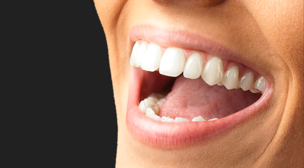 The 7 Different Types of Tooth Restoration