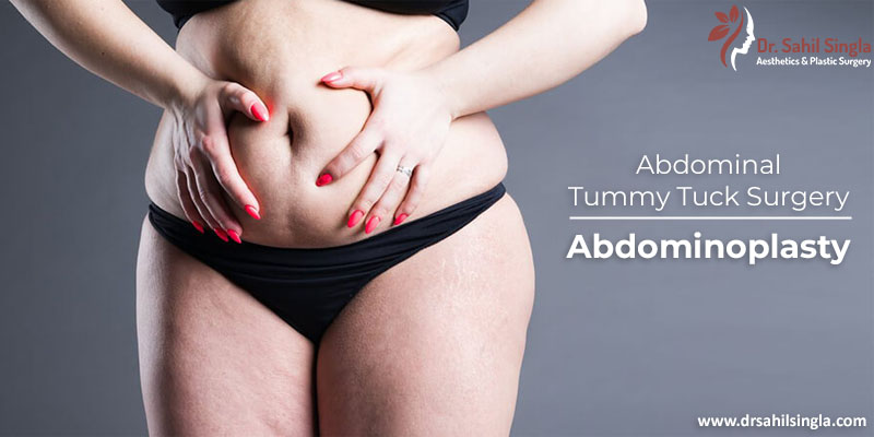 Abdominoplasty: when is it indicated and how is the surgery performed?