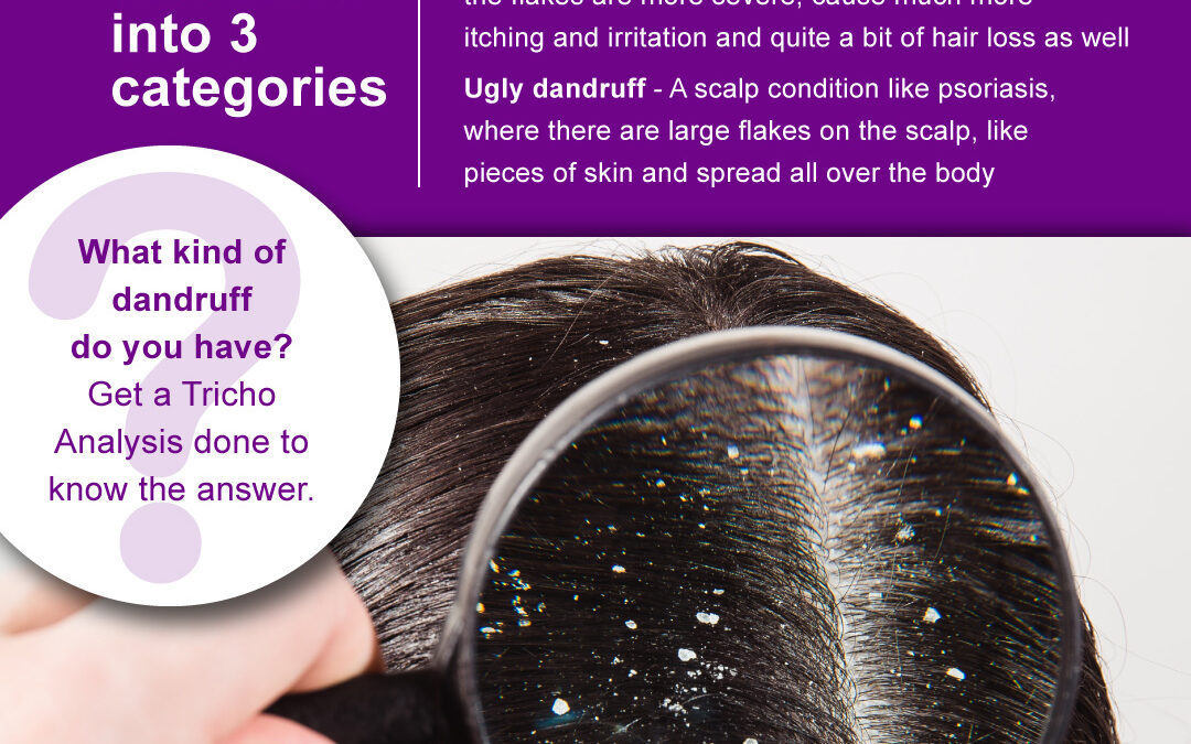 Types and Causes of Hair Loss – How Can Hair Loss be Treated?