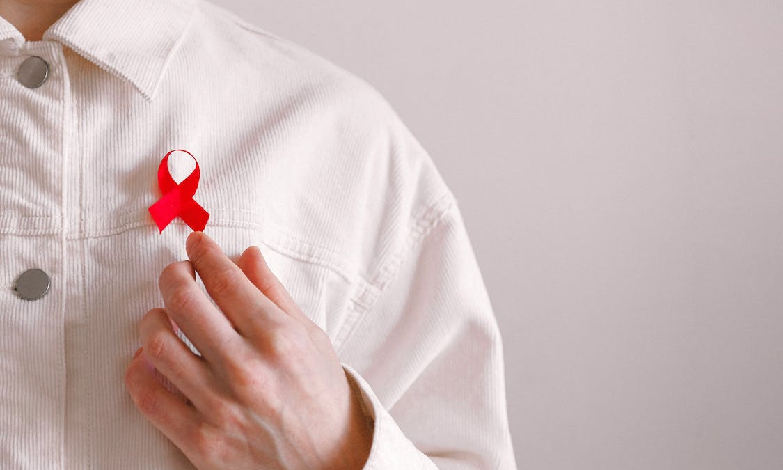 HIV/AIDS: Causes, Prevention, And Treatment