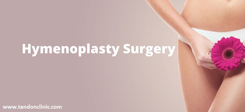 Hymenoplasty: Doing Hymen Reconstruction