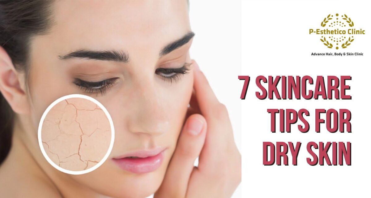 Tips for Dry Skin