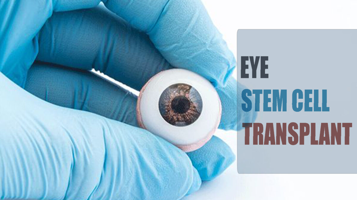 How Does Stem Cell Help to Treat Eye Problems?
