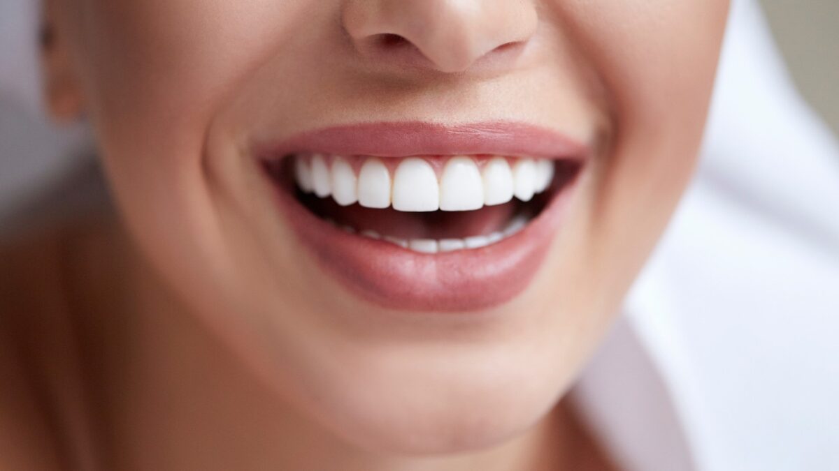 What are Porcelain Veneers and How Do They Work?