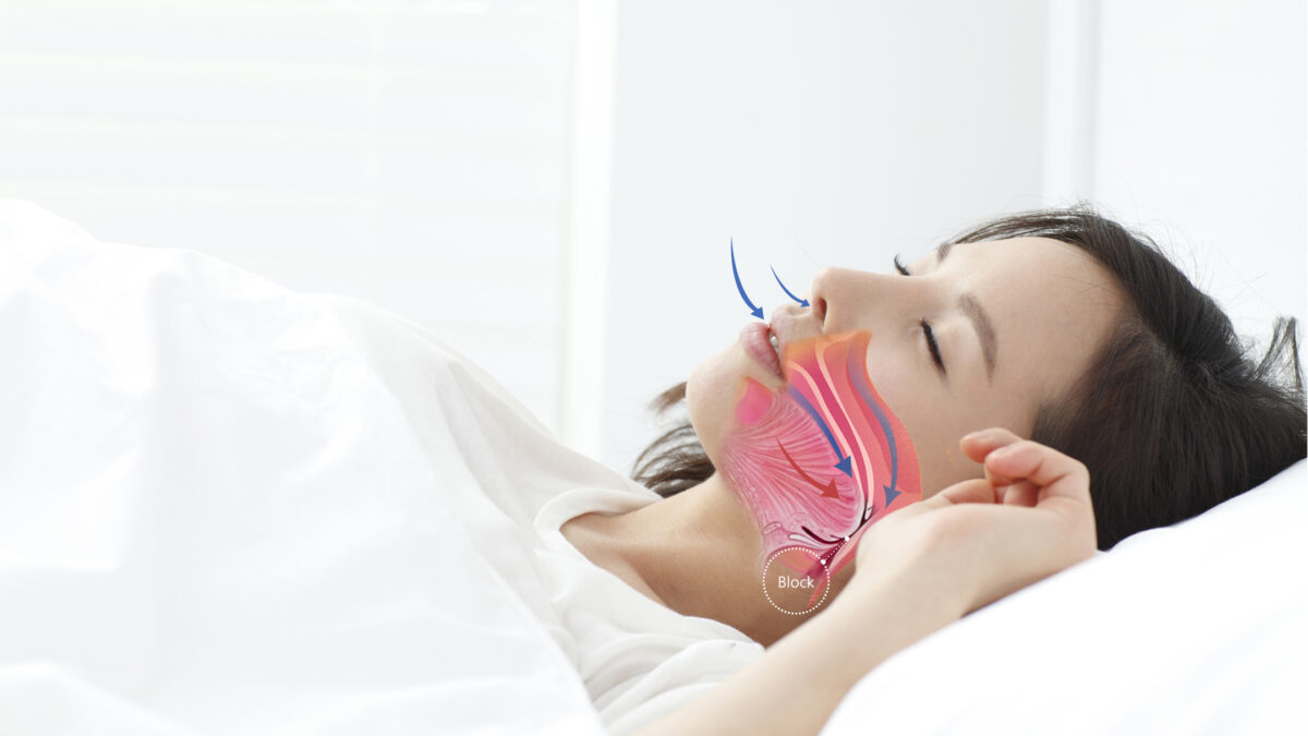How To Cure Sleep Apnea And Snoring Naturally