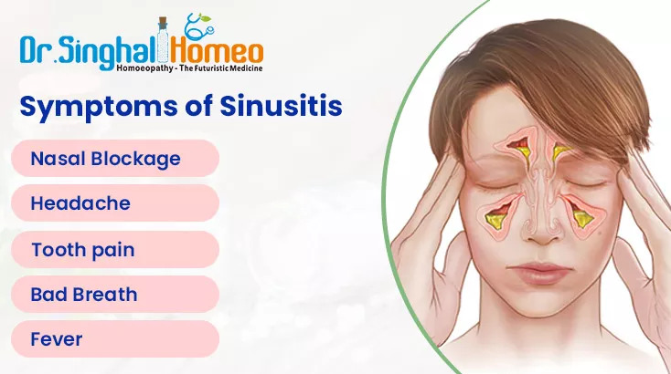 Homeopathic Treatment for Sinusitis