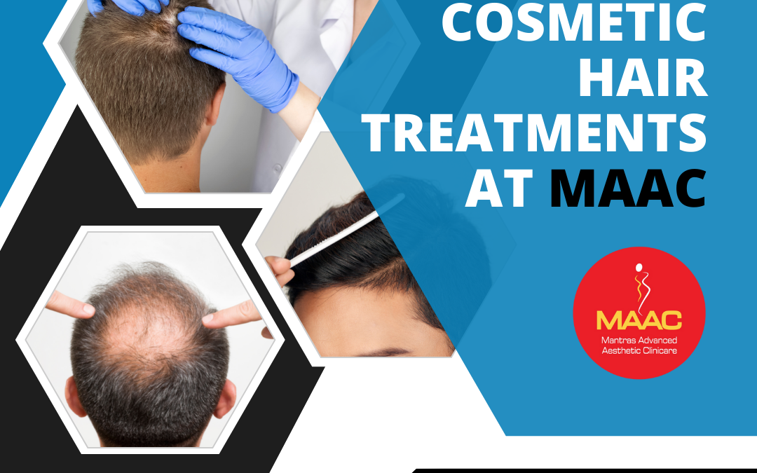Why Hair Transplant Treatment Is Best In Bangalore?