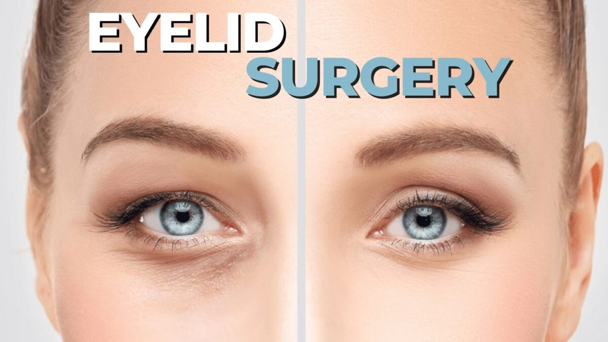 Having Eyelid Surgery – Things That You Should Know
