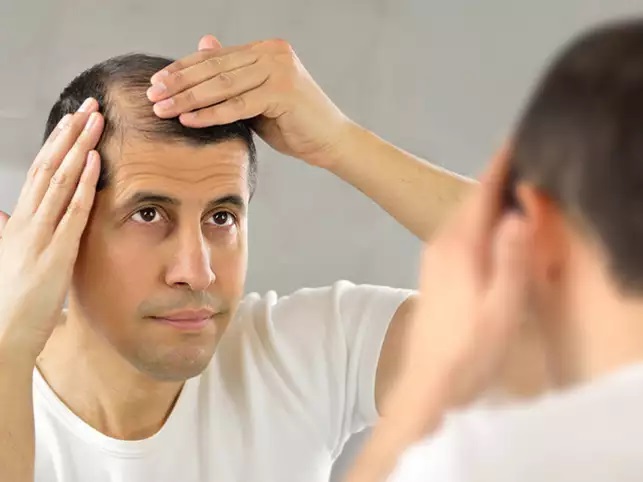How To Check Hair Transplant Eligibility And Suitable Technique?