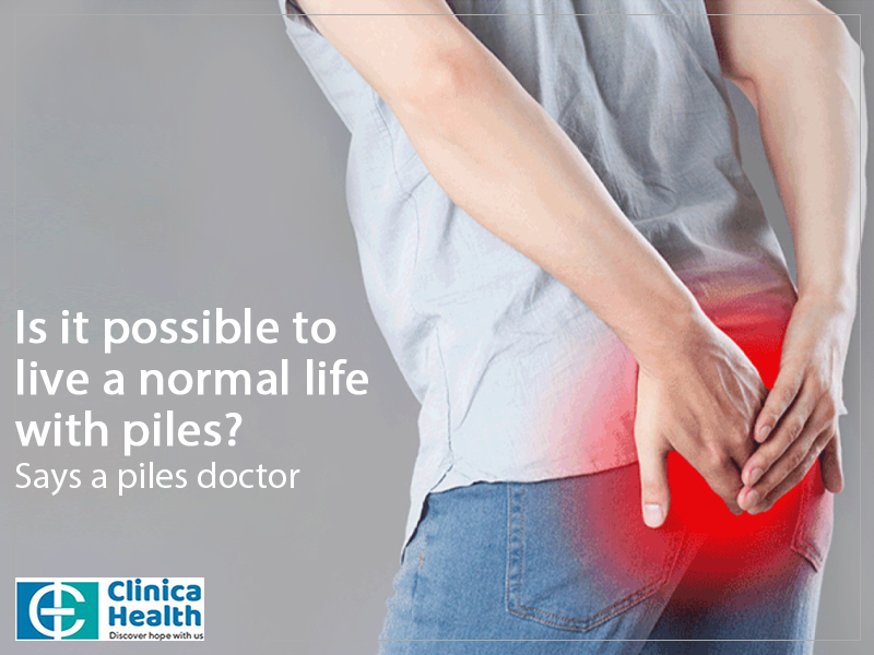 Is it possible to live a normal life with piles? Replies a piles doctor