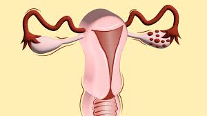 Common Gynecological Issues and How to Treat Them