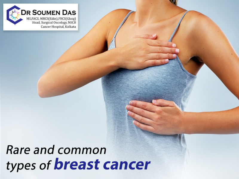Rare and common types of breast cancer