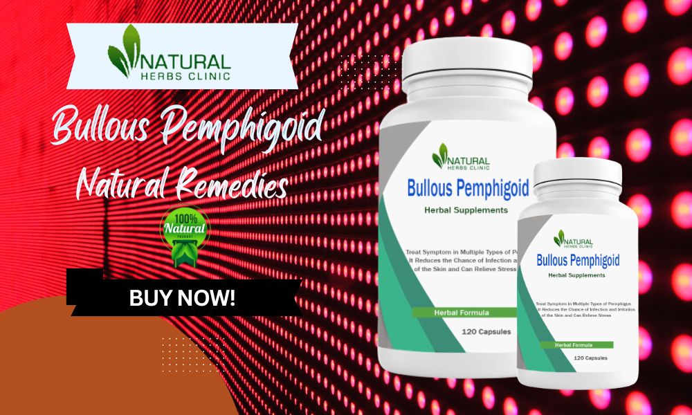 How to Plan the Perfect Bullous Pemphigoid Alternative Treatment