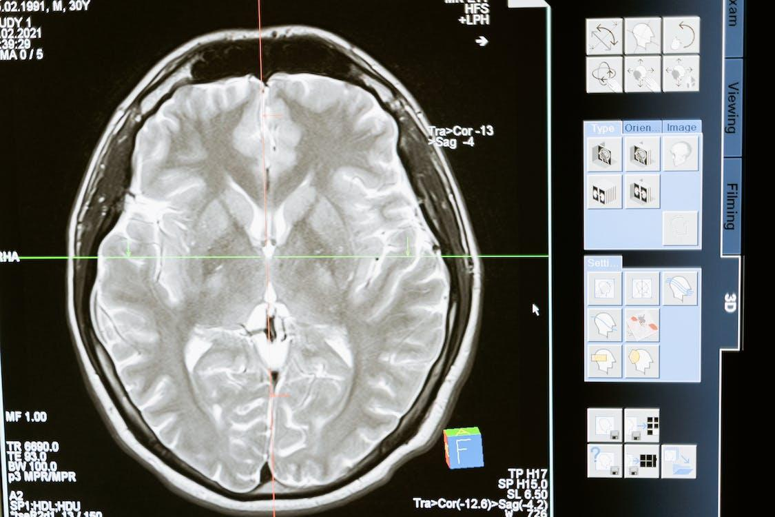 a brain scan