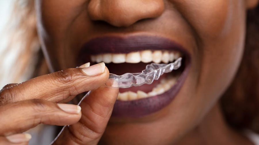 People Have Many Options Now When It Is About Choosing Aligners