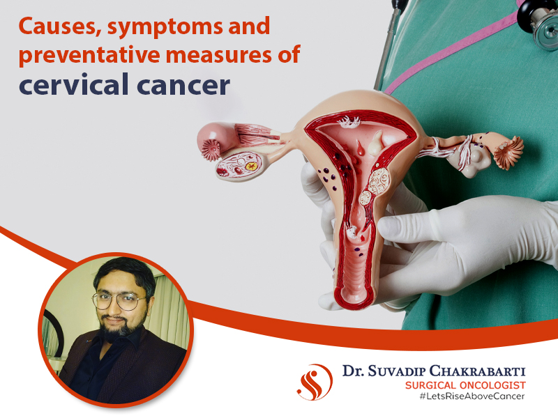 Cervical Cancer: Causes, symptoms and preventative measures