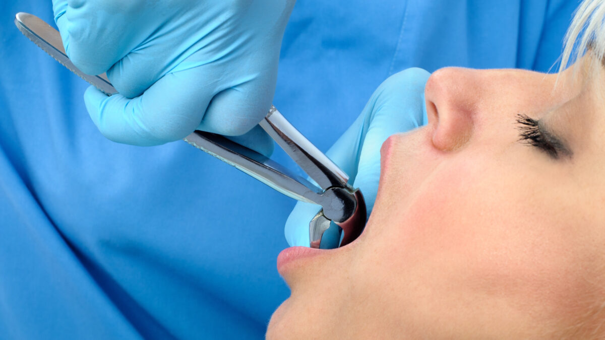 What Are The Common Reasons For Emergency Tooth Extractions?
