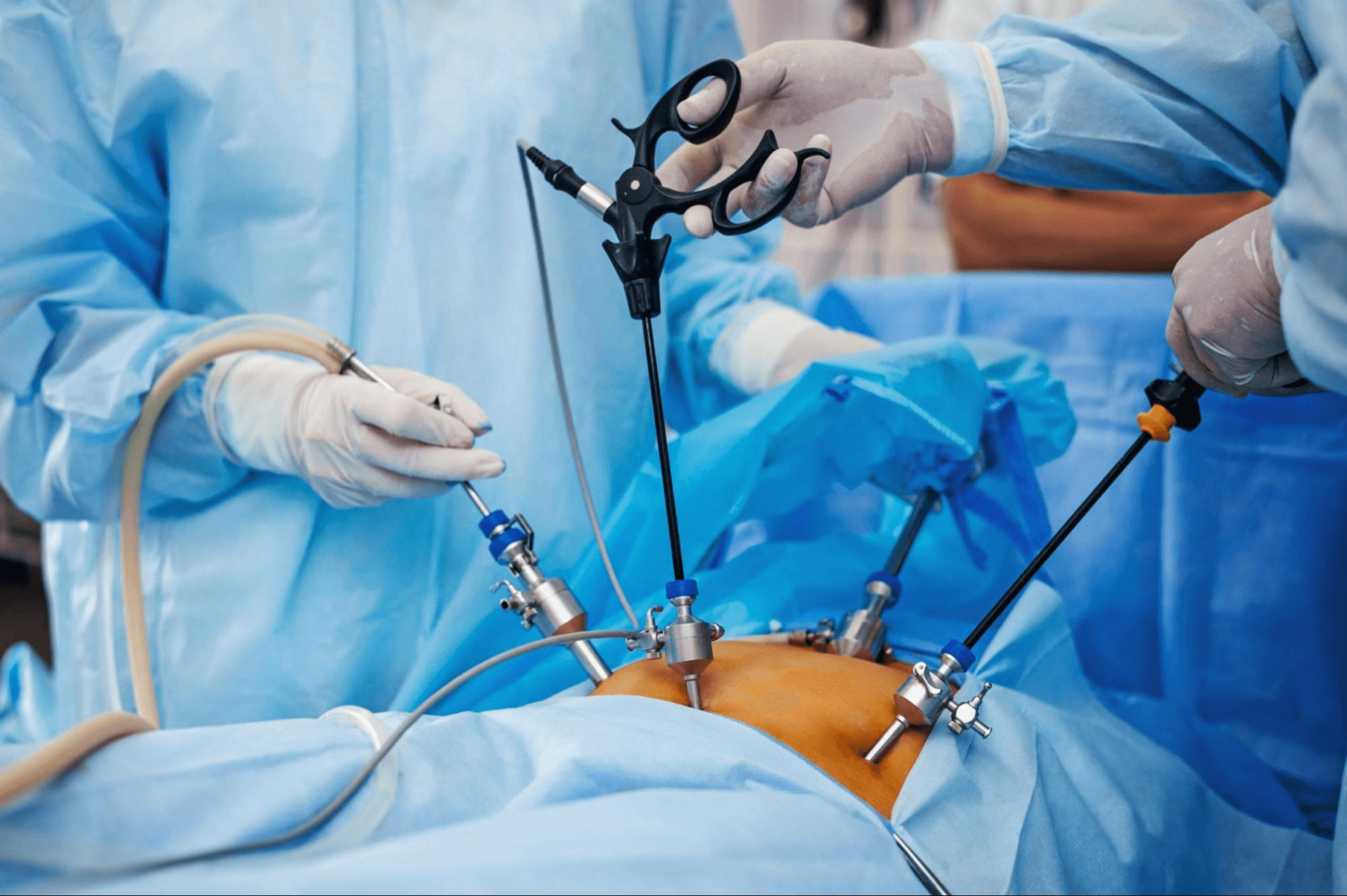 Everything You Need To Know About Laparoscopic Surgery Atoallinks