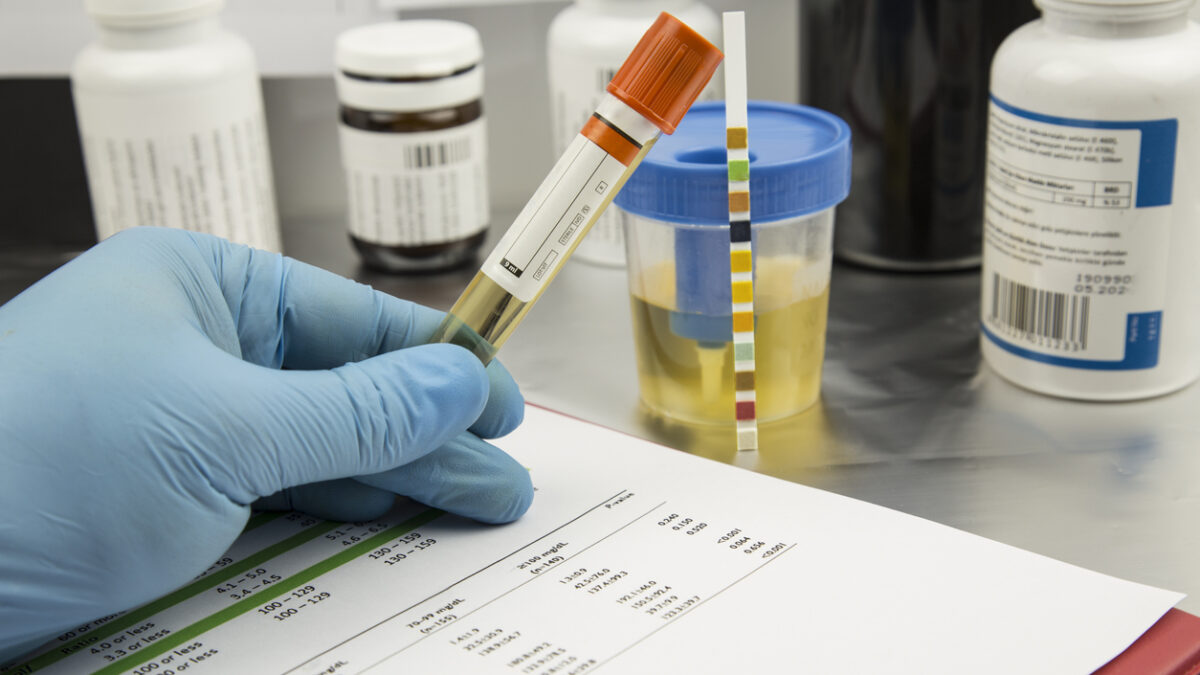 How to Read and Understand a Drug Test Results?