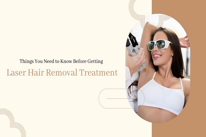 Things You Need to Know Before Getting Laser Hair Removal Treatment