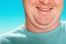 Get Rid of Under Chin Fat: Non-Surgical and Surgical Treatments