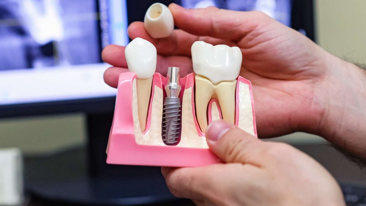 Discover Implant Courses in Houston, TX